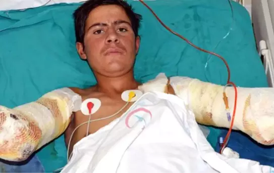 Güvercini Kurtarırken Kollarını Kaybeden Çocuk: Fenerbahçe'yi Şampiyon Görmek İstiyorum