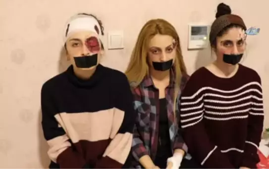 Üniversite Öğrencileri Yaptıkları Makyajlarla 'Kadına Şiddet'e' Dikkat Çektiler