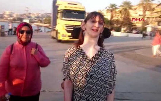 Aydın Dünyanın En Uzun Genç Kızı Üniversite Okumak İstiyor