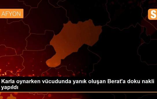 Karla oynarken vücudunda yanık oluşan Berat'a doku nakli yapıldı