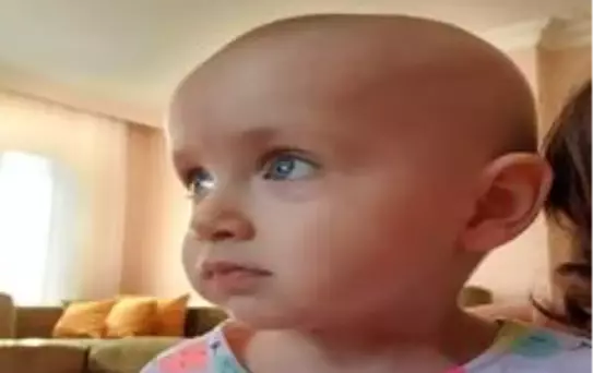 Duru bebek sağlığına kavuşmak için yardım eli bekliyor