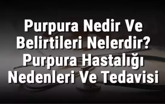Purpura Nedir ve Belirtileri Nelerdir? Purpura Hastalığı Nedenleri ve Tedavisi
