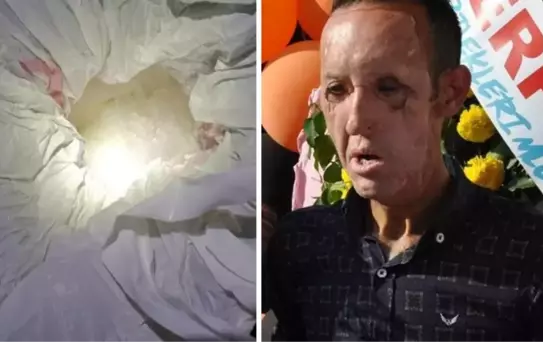 Çene nakli olan ilk kişiydi! Recep Sert, uyuşturucu operasyonunda gözaltına alındı