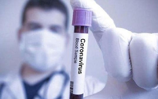 Araştırma: Midkin protein seviyesi koronavirüsün yeni belirtisi olabilir