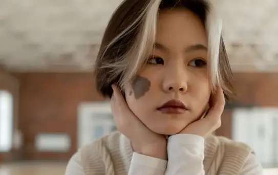 Doğum lekesi neden olur? Doğum lekelerinin türleri ve tedavi yöntemleri