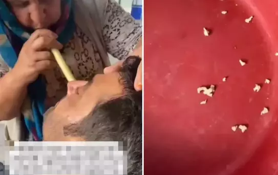 Hindistan değil Adana! Bu saçmalığa inanıp tedavi için gidenler var