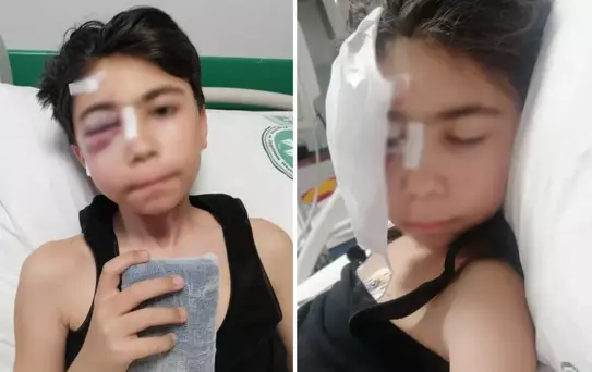 Oyun oynarken sabitlenmeyen kale direği başına düştü, çift görmeye başladı