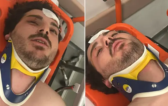 Ünlü oyuncu Mehmet Akif Akdeniz, trafikte öldüresiye dövüldü