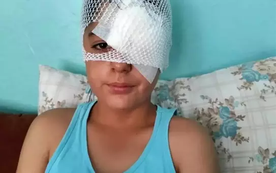 Köpek Saldırısından Kaçan Çocuğa Otomobil Çarptı