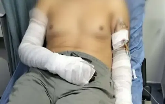 Manisa'da Sanayi Sitesinde Patlama: 2 Yaralı