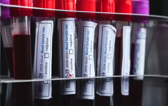 Acı eşiği en yüksek kan grubu belli oldu