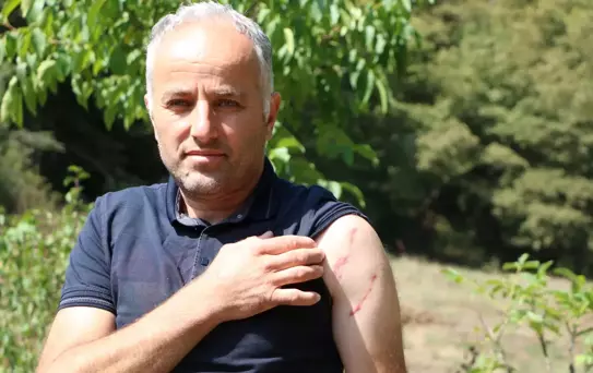 Mudurnu'da Ayı Saldırısı: 1 Yaralı