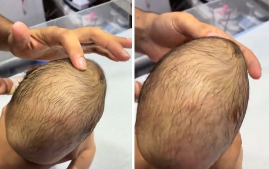 Yeni doğan bebeğin bıngıldağına basan doktorun gördüğü manzara korkunç