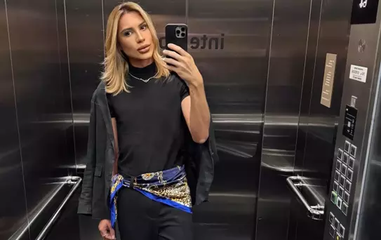 Estetik ameliyat Brezilyalı fenomeni hayattan kopardı