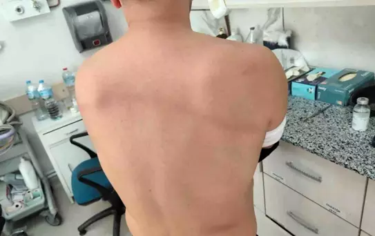 Denizli'de CHP'li Belediye Başkanı'na Şiddet ve Mobing İddiası