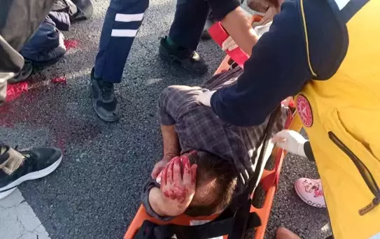 Motosiklet Sürücüsü Sokak Köpeğine Çarpmamak İçin Bariyere Çarptı