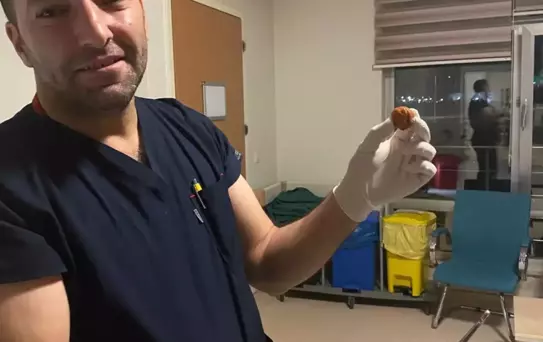 Zihinsel Engelli Kadının Yeme Borusundaki Ceviz Çıkarıldı