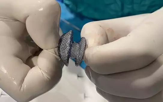 Kalpte Delik Tedavisinde Yeni Yöntemler