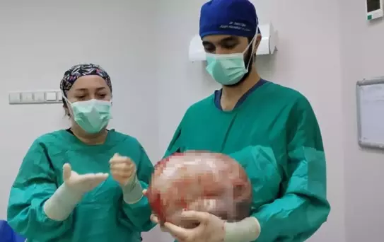 2 ayda 9 aylık hamile gibi büyüdü, doktorlar görünce apar topar ameliyata aldı