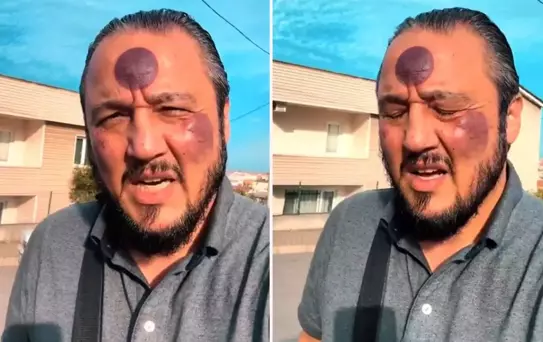 Yüzüne yaptırdığı işlemden sonra bu hale geldi, yine de savundu