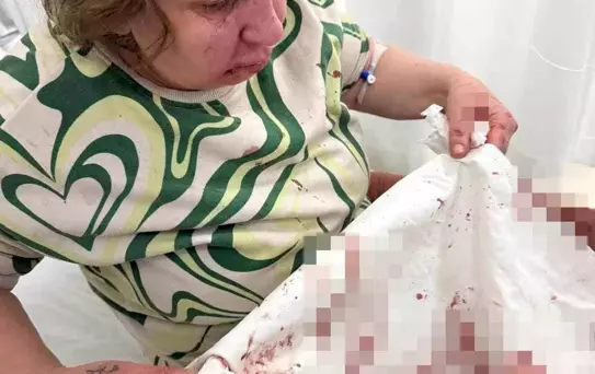 Denizli'de Gürültü Kavgası Şiddetle Bitti