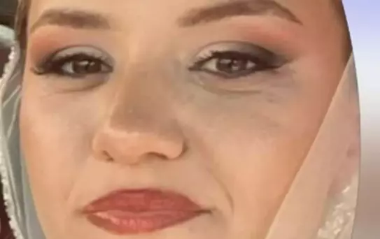 Sağlıkçıları taşıyan servis kaza yaptı, genç hemşire hayatını kaybetti