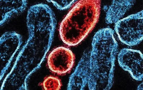 Hindistan'da Nipah Virüsü Salgını