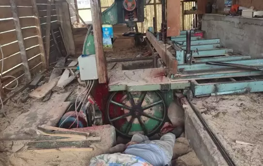 Evinin bahçesinde korkunç son! Başı şerit testereye sıkıştı