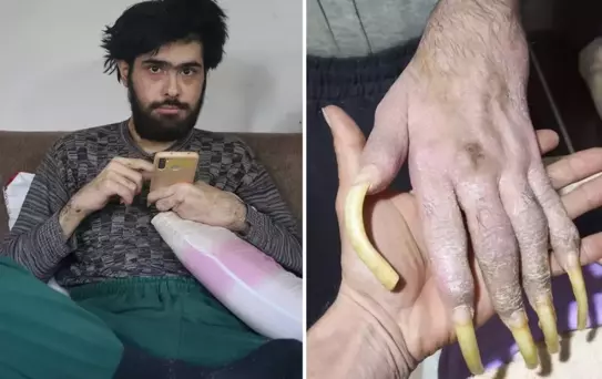 Türkiye'nin konuştuğu Barış'ın yeni işini ve son halini görenler şaşıp kalıyor