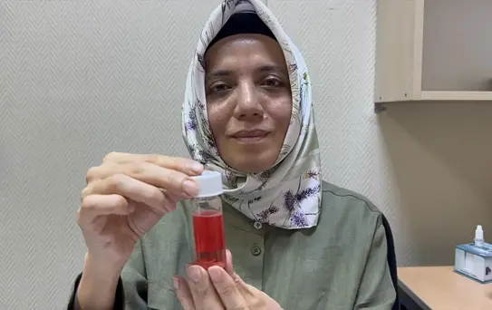 SDÜ Göz Bankası: 100'den Fazla Kornea Nakli