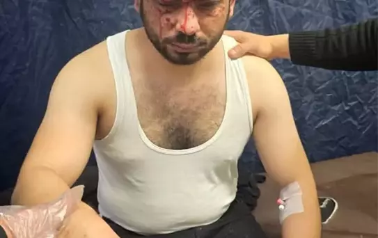 Suriye'de Patlama: Üç Yaralı