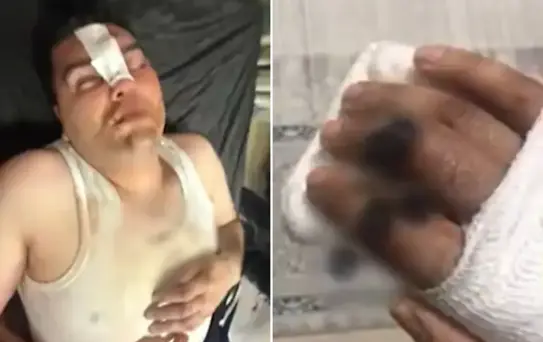 Hesabı ortak ödediler, dayağı tek başına yedi! Her şey 13 binlik 'çerez' ile başladı