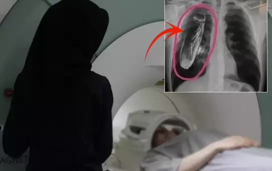 Hastaya ''Göğsünde canlı böcek var'' dendi, gerçek çok başka çıktı