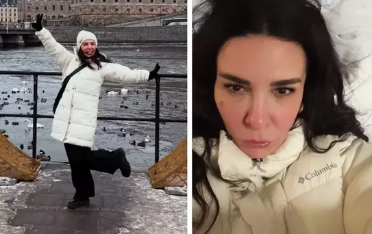 Ünlü şarkıcı Fatma Turgut'un yüzü soğuktan bu hale geldi