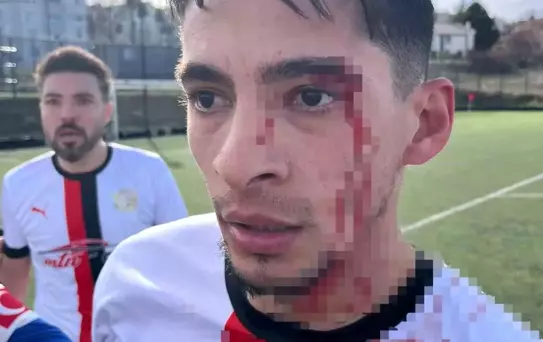 Bilecik'te Futbol Maçında Kavga: 3 Yaralı