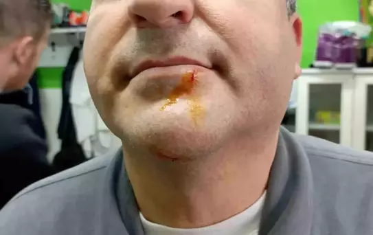 Zonguldak'ta 3. Lig maçı sonrası gerginlik: 2 gazeteci darbedildi, 2 polis yaralandı