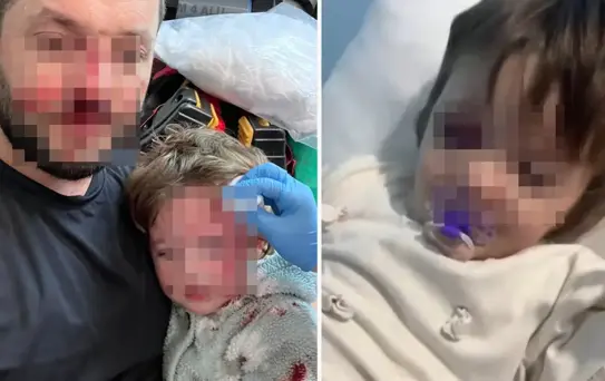 14 aylık İkra bebeğin yaralandığı olayda iki taraf da birbirini suçladı