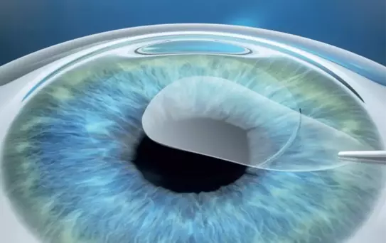 Sağlam Kornea Üzerinde İlaç Geçişi İlk Kez Doğrudan Ölçüldü