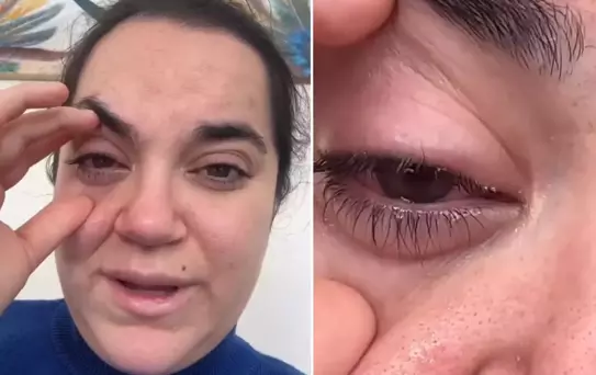 Bulaşık makinesi tableti kadının gözüne patladı, kör olma korkusu yaşadı