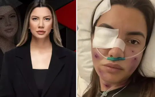 Fulya Öztürk trafik kazası mı geçirdi? Elden ele dolaşan görselle ilgili açıklama var