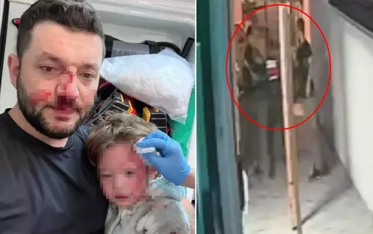 İkra bebeğin darbedildiği iddia edilen kavganın güvenlik kamerası görüntüleri ortaya çıktı