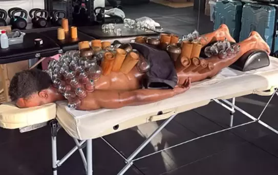 Dünyaca ünlü isim hacamat yaptırdı