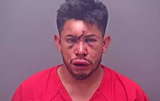 13 yaşındaki çocuk, evdeki olayı görünce babasını bu hale getirdi