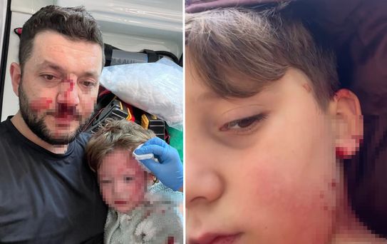 Yalova'da husumet büyüyor: Aynı ailenin 8 yaşındaki çocuğu da yaralandı