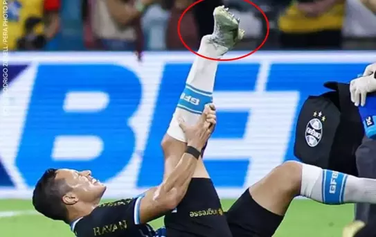 Süper Lig'in eski yıldızı ayağını kırdı 