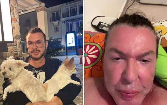 Yüzünü gerdiren Kuşum Aydın'ın son hali ortaya çıktı