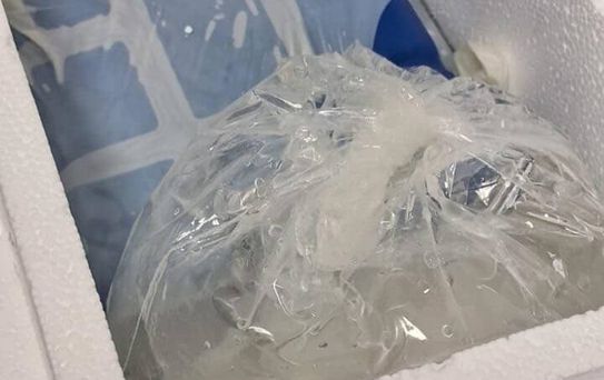 Sahipsiz Köpekler Adamın Parmakını Kopardı