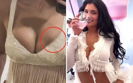 Milyonlarca hayranı bu sorunun cevabını arıyor: Kylie Jenner’ın silikonu mu patladı?