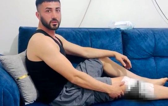 Nizip'te başıboş köpek saldırısında yaralanan 2 kişi belediyeye tepki gösterdi