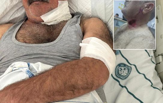 Severek beslediği hayvan bu hale getirdi